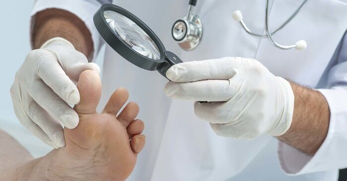 Esame diagnostico delle unghie dei piedi